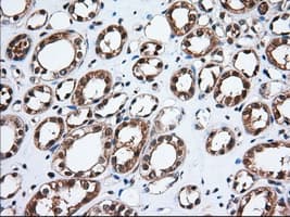 Monoclonal Mouse anti-Human TS / Thromboxane Synthase Antibody (clone OTI1A9, IHC, IF, WB)
