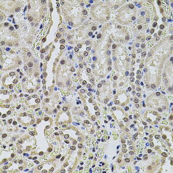 Polyclonal Rabbit anti-Human SMARCC2 Antibody (IHC, WB)