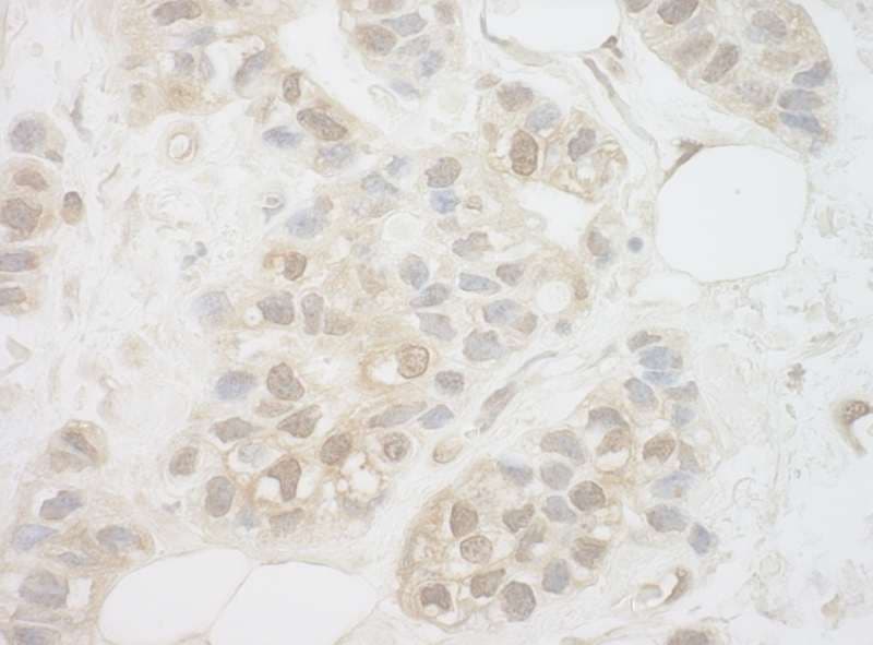 UCKL1 Antibody (aa1-50)