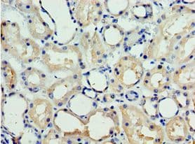 Polyclonal Rabbit anti-Human CHD2 Antibody (aa1569-1828, IHC)