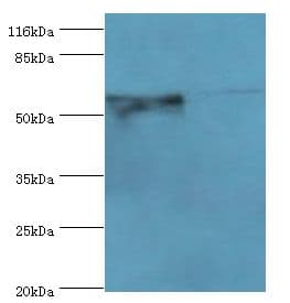 CYP4F11 Antibody (aa38-524, Biotin)