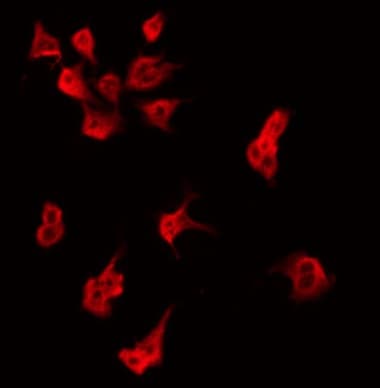 AIG1 Antibody