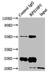 RPS10 / Ribosomal Protein S10 Antibody