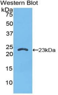 PSIP1 / LEDGF Antibody (aa311-469, Biotin)