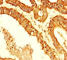KDM4C / JMJD2C Antibody (aa450-600)