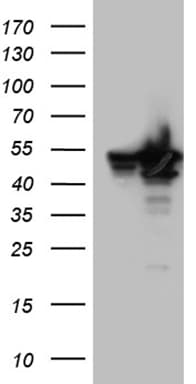 Monoclonal Mouse anti-Human BAG5 Antibody (clone OTI2D6, WB)