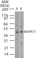 MAPK11 / SAPK2 / p38 Beta Antibody (aa39-59)