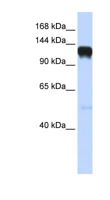 Polyclonal Rabbit anti-Human EPHA5 / EPH Receptor A5 Antibody (aa792-841, WB)