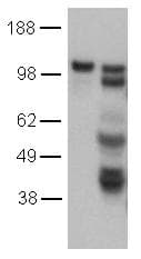 IHC-plus™ CD144 / CDH5 / VE Cadherin Antibody (clone 16B1)
