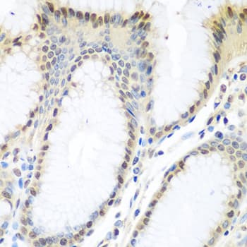 TDP-43 / TARDBP Antibody