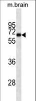 INA / Alpha Internexin Antibody (aa290-319)
