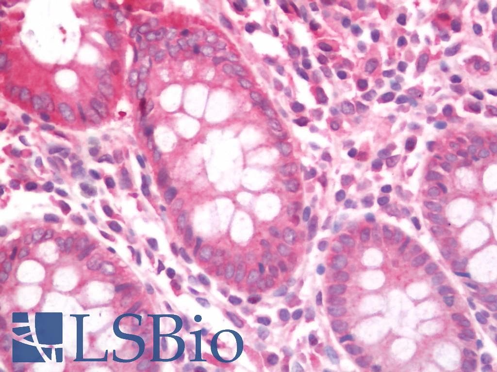 IHC-plus™ CORO1B Antibody (aa450-489)