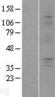 P2RY6 / P2Y6 Protein (Over-Expression Lysate Myc-DDK (Flag))