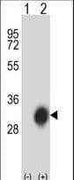 HLA-DPB1 Antibody (aa77-105)