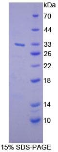 Human DGKG Protein (Recombinant His-T7)