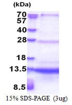 Human SEC61B Protein (Recombinant His)