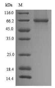 Mouse DLAT / PDC-E2 Protein (Recombinant 6His, N-terminus)