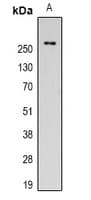 Monoclonal Mouse anti-Human FN1 / Fibronectin Antibody (IHC, WB)