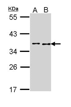 Polyclonal Rabbit anti-Human BCCIP Antibody (aa181-273, IHC, WB)
