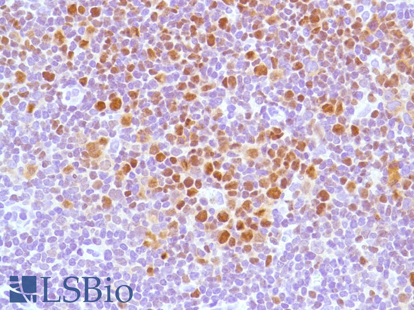 Monoclonal Rabbit anti-Human BCL6 Antibody (clone SP155, C-Terminus, IHC)