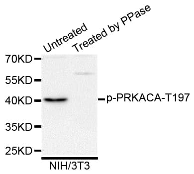 PRKACA + PRKACB Antibody (phospho-Thr198)
