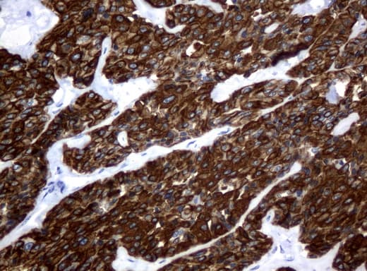 KRT18 / CK18 / Cytokeratin 18 Antibody (aa69-372, clone UMAB50)