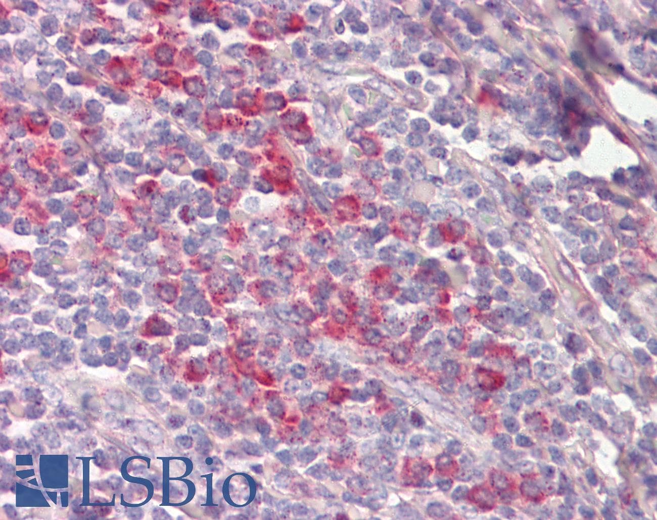 IHC-plus™ FIS1 Antibody