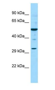 NR0B1 / DAX1 Antibody (aa401-450)