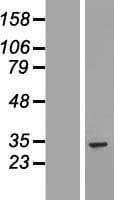 Human UTP11L Protein (Over-Expression Lysate Myc-DDK (Flag))