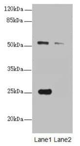 ERO1A / ERO1L Antibody