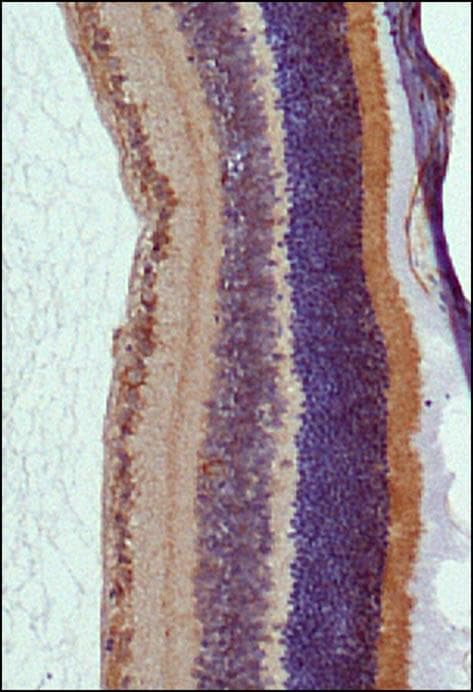 Polyclonal Rabbit anti-Human RP1 Antibody (aa2000-2156, IHC, IF, WB)