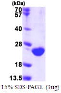Human DUSP3 / VHR Protein (Recombinant His)