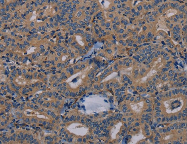 Peptide YY / PYY Antibody