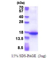 Human MFAP3 Protein (Recombinant His)