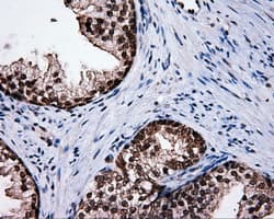 SRR / Serine Racemase Antibody (clone OTI7E8, Carrier-free)
