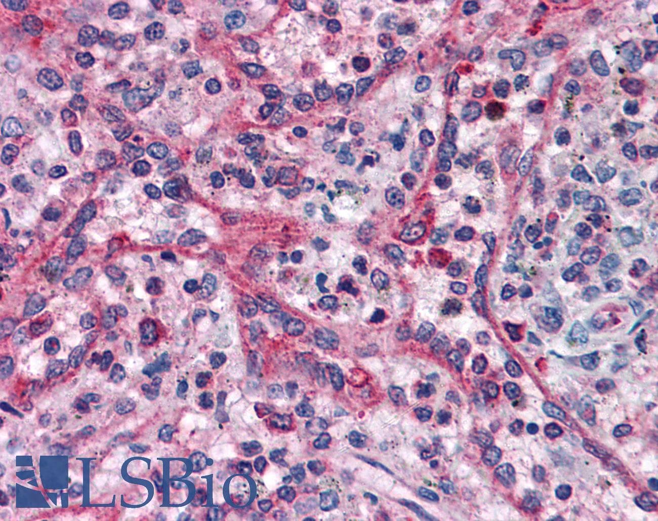 IHC-plus™ TXNDC1 / TMX1 Antibody (aa269-280)