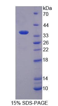 Human EEF1A2 Protein (Recombinant His, N-Terminal)