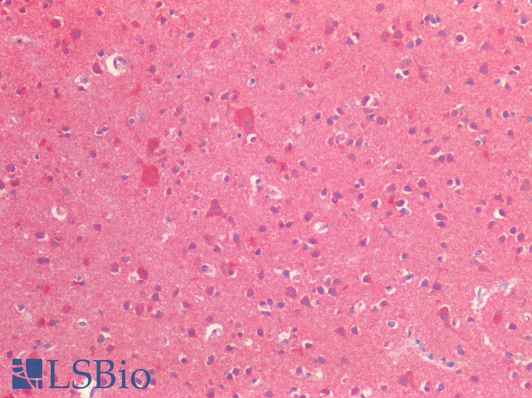 PathPlus™ EPHA4 / EPH Receptor A4 Antibody (Internal)