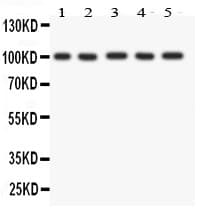 FGFR4 Antibody (aa22-206)