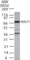 IHC-plus™ Polyclonal Rabbit anti-Human MALT1 Antibody (aa43-57, IHC, WB)