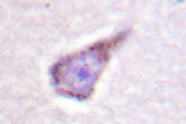 WAS / WASP Antibody (Glu284)