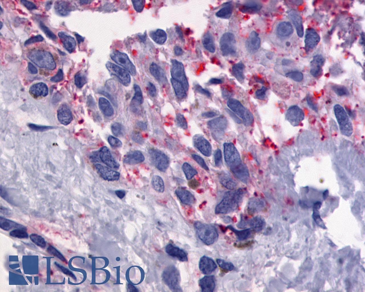 IHC-plus™ Polyclonal Rabbit anti-Human ADGRG1 / GPR56 Antibody (Cytoplasmic Domain, IHC)