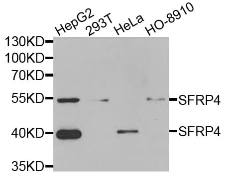IHC-plus™ SFRP4 Antibody