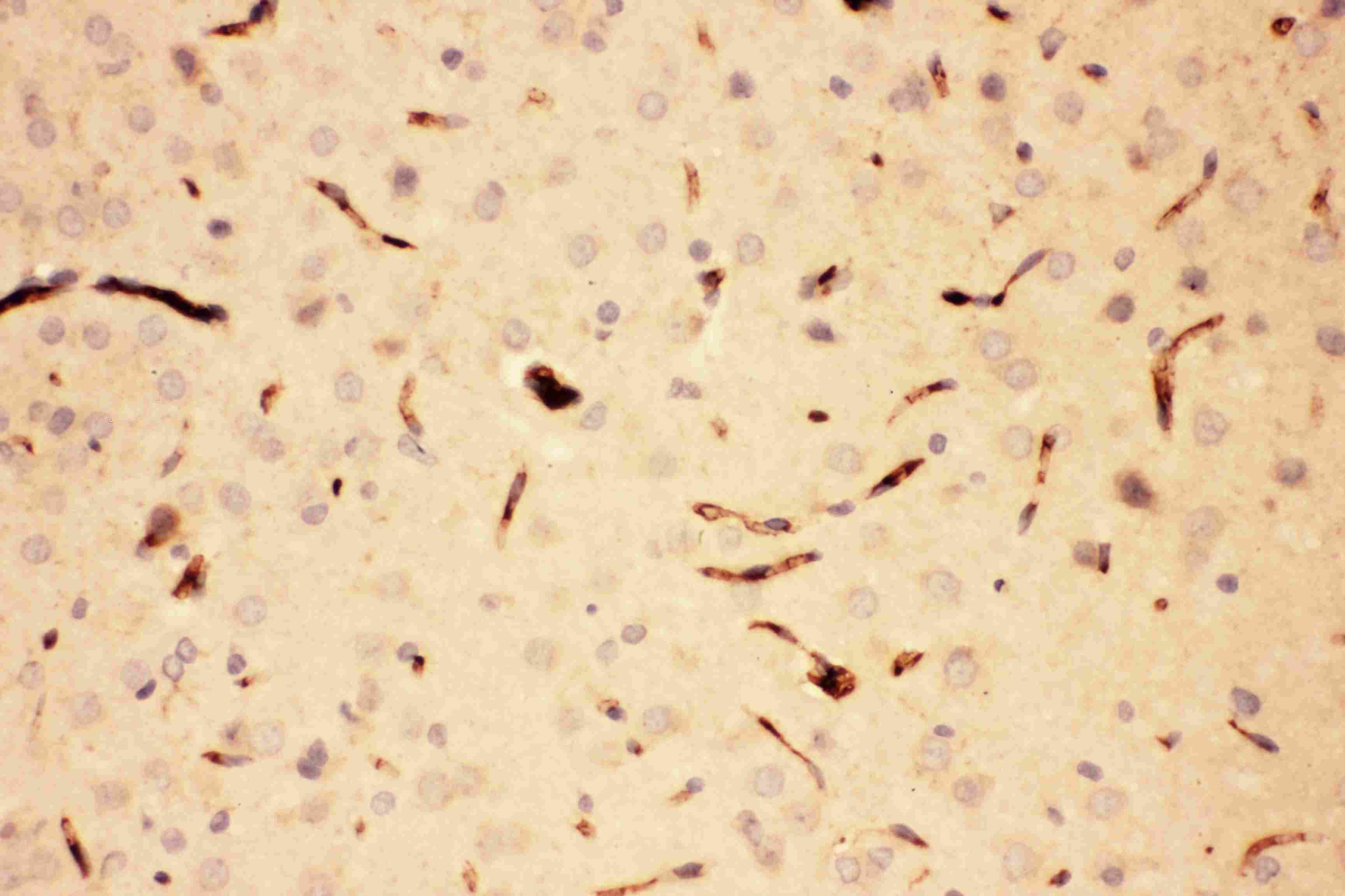 POMC / Proopiomelanocortin Antibody (aa138-176)