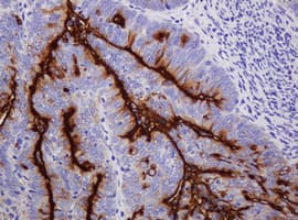 EMA / MUC1 Antibody (clone OTI3A7)
