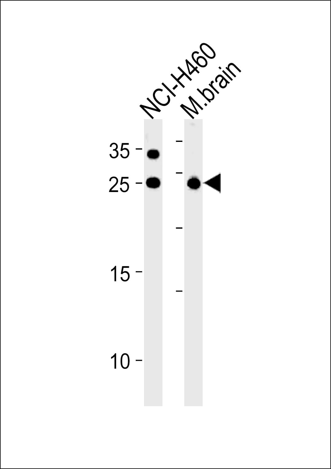 Polyclonal Rabbit anti-Human RAB3C Antibody (aa136-164, WB)