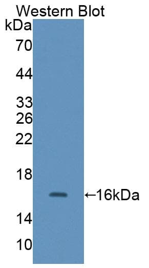 CALD1 / Caldesmon Antibody