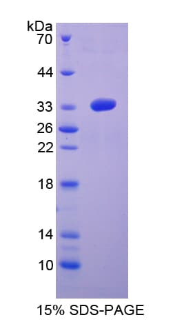 Human MAP2K6 / MEK6 / MKK6 Protein (Recombinant His-T7)