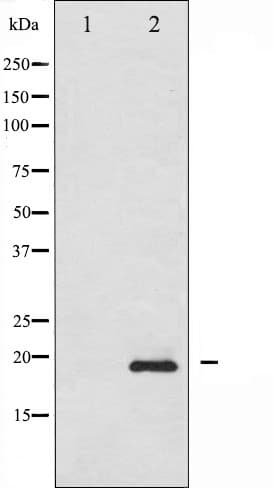 Polyclonal Rabbit anti-Human STMN1 / Stathmin / LAG Antibody (phospho-Ser15, IHC, IF, WB)