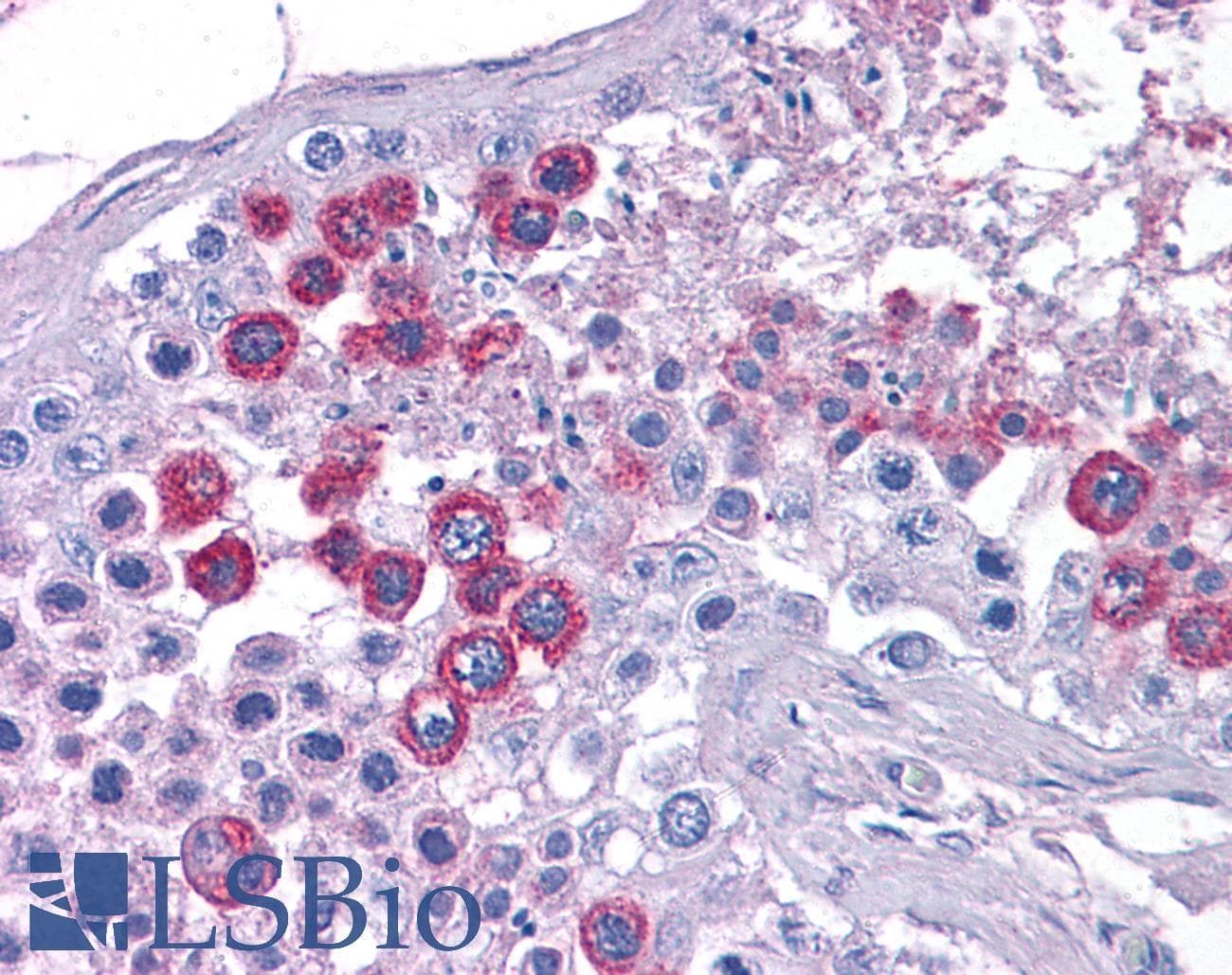 IHC-plus™ ATP11A Antibody
